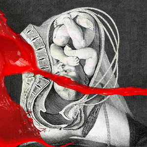 I Come with Knives - IAMX | Song Album Cover Artwork